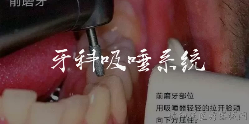 牙科吸唾系统:牙科吸唾系统的主要功能是什么？ - 2026最新系统问答知识盘点大全