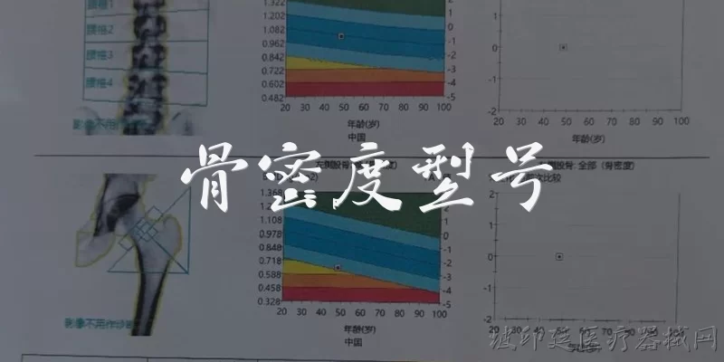 骨密度型号:什么是骨密度型号? - 2026最新型号问答知识盘点大全